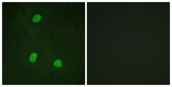 NIPA rabbit pAb Antibody