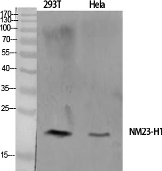 NM23-H1 rabbit pAb Antibody