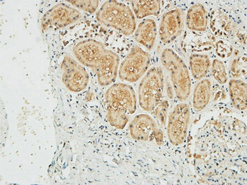 NM23-H1 rabbit pAb Antibody