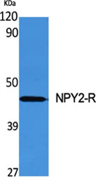 NPY2-R rabbit pAb Antibody