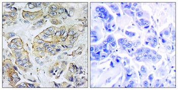 NPY5-R rabbit pAb Antibody