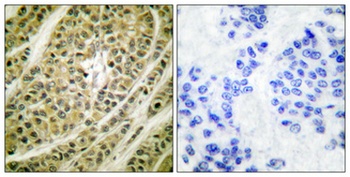 NY-CO-9 rabbit pAb Antibody