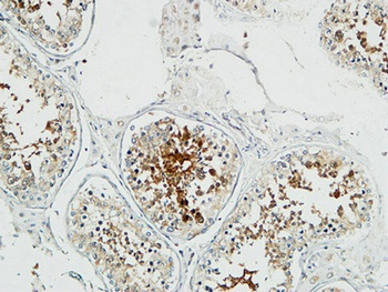 Op18 rabbit pAb Antibody