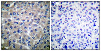 p130 Cas rabbit pAb Antibody