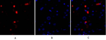 p53 Rabbit pAb Antibody