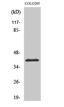 p53R2 rabbit pAb Antibody