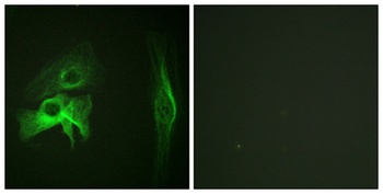 PAKα rabbit pAb Antibody