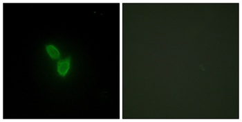 PARD3A rabbit pAb Antibody