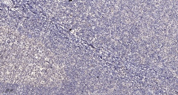 PARD3A rabbit pAb Antibody