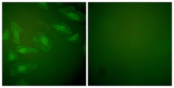 PARK7 rabbit pAb Antibody