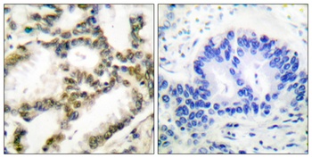 PARK7 rabbit pAb Antibody