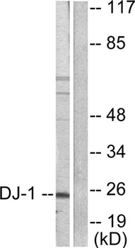 PARK7 rabbit pAb Antibody