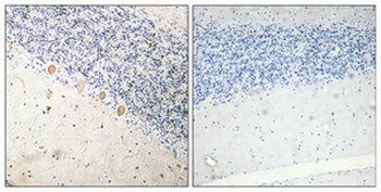 PFKM rabbit pAb Antibody
