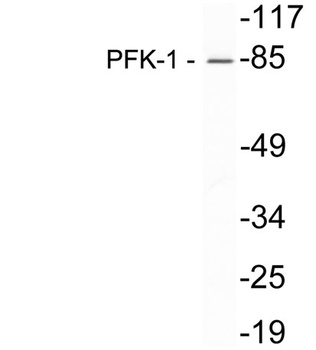 PFKM rabbit pAb Antibody