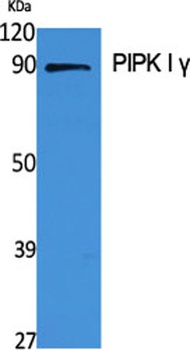 PIPK I γ rabbit pAb Antibody