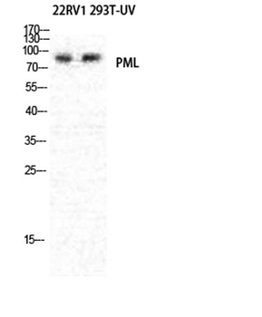 PML rabbit pAb Antibody