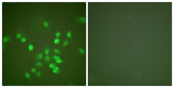 PML rabbit pAb Antibody