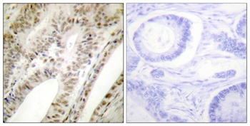 PML rabbit pAb Antibody