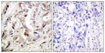 PR rabbit pAb Antibody