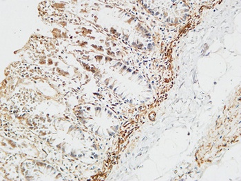 Ptx3 rabbit pAb Antibody
