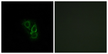 Rad GTPase rabbit pAb Antibody