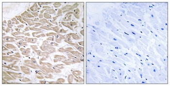 Rad GTPase rabbit pAb Antibody