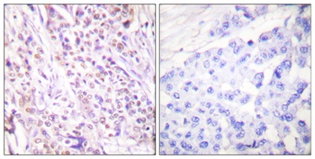 Rad17 rabbit pAb Antibody