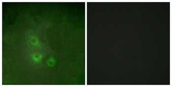 Rak rabbit pAb Antibody