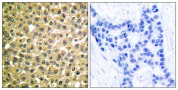 RARβ rabbit pAb Antibody
