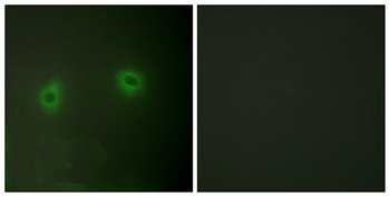 Renin Receptor rabbit pAb Antibody