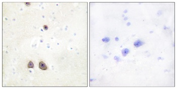 Renin Receptor rabbit pAb Antibody