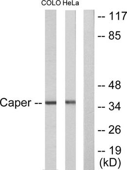 Renin Receptor rabbit pAb Antibody