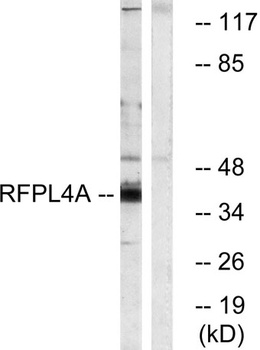 RFPL4A rabbit pAb Antibody
