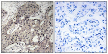 Ribosomal Protein L3 rabbit pAb Antibody