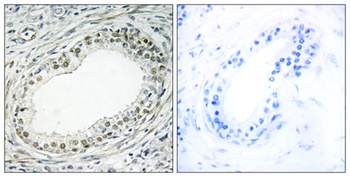 Ribosomal Protein L36 rabbit pAb Antibody