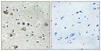 Ribosomal Protein S12 rabbit pAb Antibody