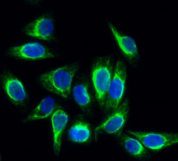 Rock-1 rabbit pAb Antibody