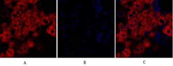 Rock-1 rabbit pAb Antibody