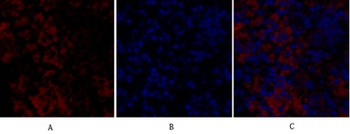 Rock-1 rabbit pAb Antibody