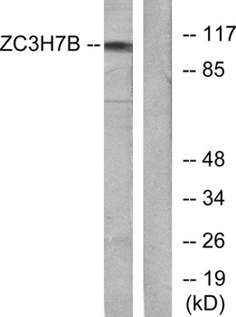 RoXaN rabbit pAb Antibody