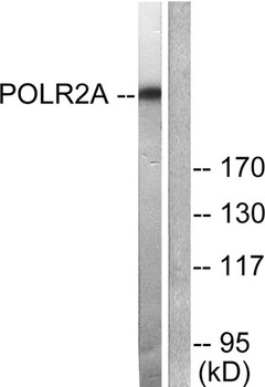 Rpb1 rabbit pAb Antibody