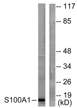 S-100 α rabbit pAb Antibody