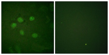SAE1 rabbit pAb Antibody