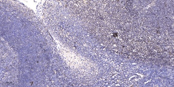 SAE1 rabbit pAb Antibody