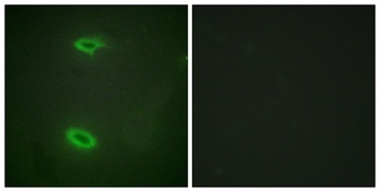 SAPAP1 rabbit pAb Antibody