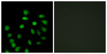 SCAND1 rabbit pAb Antibody