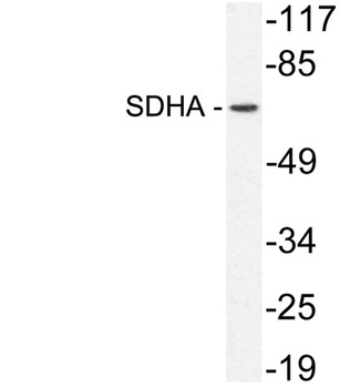 SDHA rabbit pAb Antibody