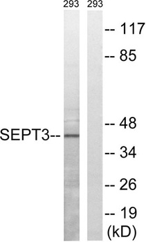 Septin 3 rabbit pAb Antibody