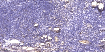 Serpin B12 rabbit pAb Antibody