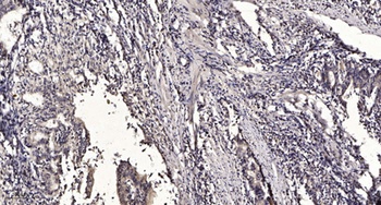 SHIP-1 rabbit pAb Antibody